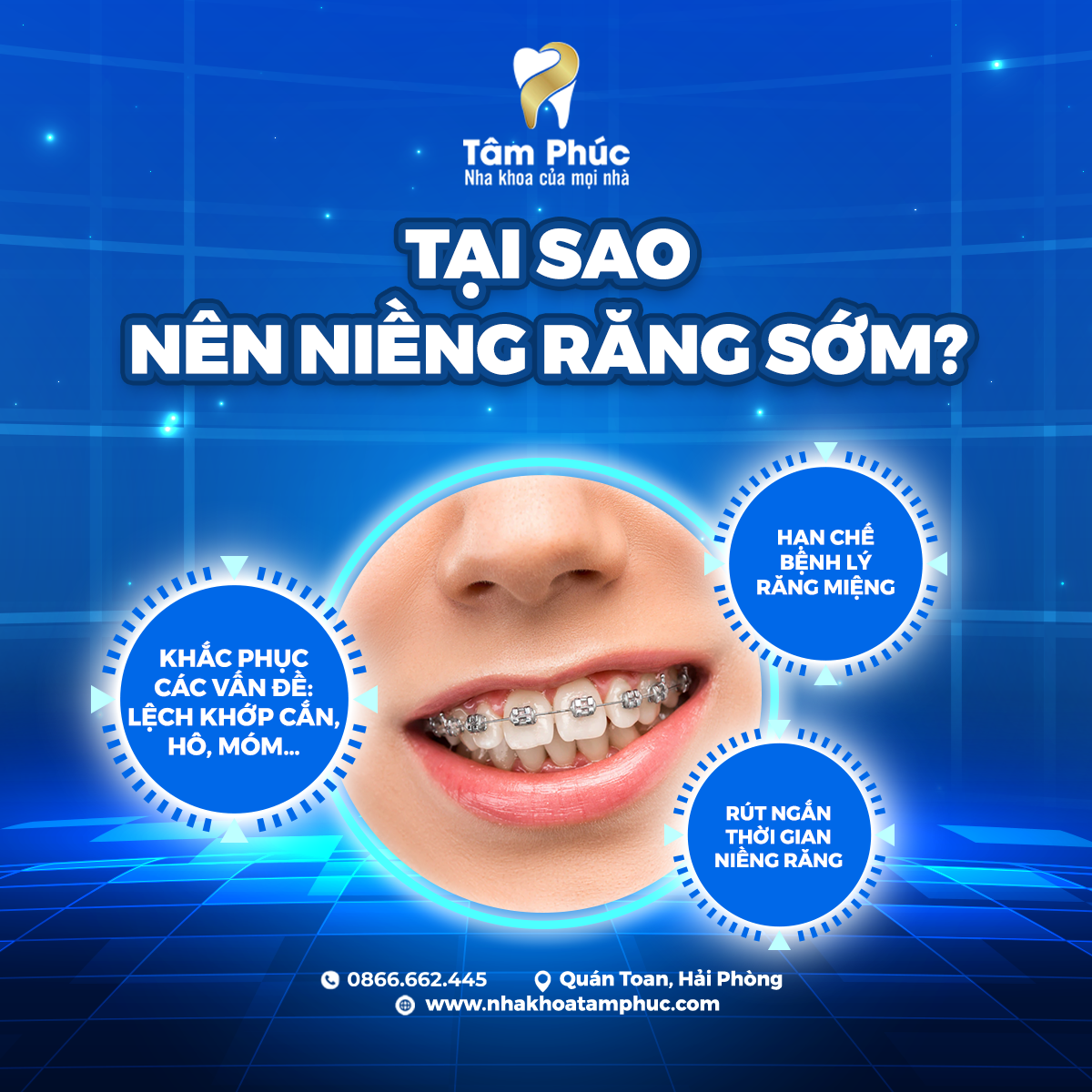 Niềng răng càng sớm càng tốt